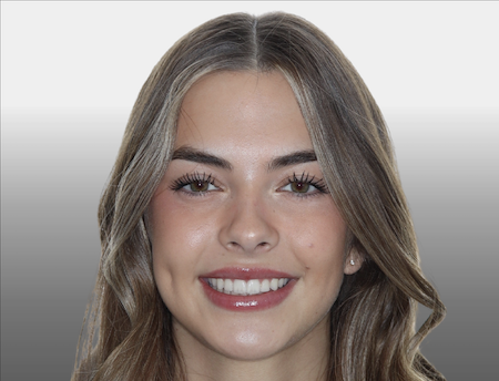 Smiling female headshot after completing orthodontic treatment.